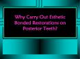 Why Carry Out Esthetic Bonded Restorations on Posterior Teeth? PowerPoint PPT Presentation