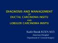 Diagnosis and Management OF Ductal Carcinoma Insitu AND Lobuler Carcinoma Insitu PowerPoint PPT Presentation