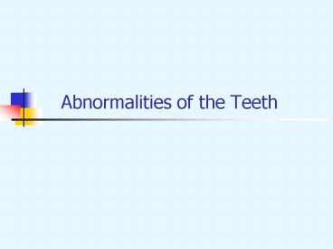 Abnormalities of the Teeth