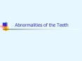 Abnormalities of the Teeth PowerPoint PPT Presentation