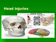 Head injuries PowerPoint PPT Presentation