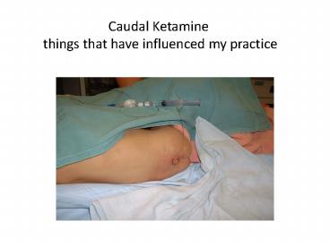 Caudal Ketamine things that have influenced my practice