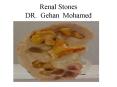 Renal Stones DR. Gehan Mohamed PowerPoint PPT Presentation