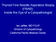 Thyroid Fine Needle Aspiration Biopsy (FNAB): Inside the Eye of a Cytopathologist PowerPoint PPT Presentation