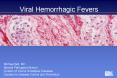 Viral Hemorrhagic Fevers PowerPoint PPT Presentation