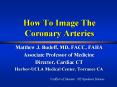 How To Image The Coronary Arteries PowerPoint PPT Presentation