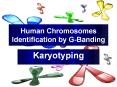 Human Chromosomes Identification by G-Banding PowerPoint PPT Presentation