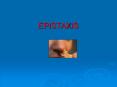 EPISTAXIS BY PowerPoint PPT Presentation