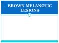 BROWN MELANOTIC LESIONS PowerPoint PPT Presentation