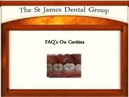 All You Need To Know About Cavities