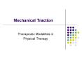 Mechanical Traction PowerPoint PPT Presentation