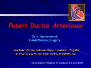 Patent Ductus Arteriosus