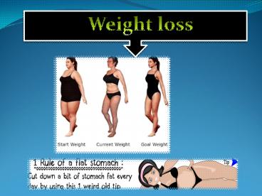 Is weight loss surgery a good option?