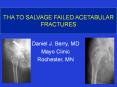 THA TO SALVAGE FAILED ACETABULAR FRACTURES PowerPoint PPT Presentation