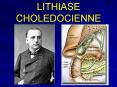 LITHIASE  CHOLEDOCIENNE PowerPoint PPT Presentation