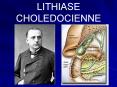 LITHIASE  CHOLEDOCIENNE PowerPoint PPT Presentation