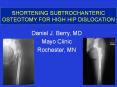 SHORTENING SUBTROCHANTERIC OSTEOTOMY FOR HIGH HIP DISLOCATION PowerPoint PPT Presentation