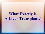 Procedures For Successfully Carrying Out A Liver Transplant