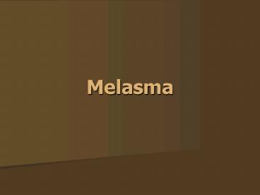Melasma