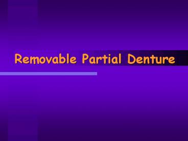 Removable Partial Denture