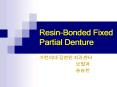 Resin-Bonded Fixed Partial Denture PowerPoint PPT Presentation