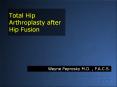 Total Hip Arthroplasty after Hip Fusion PowerPoint PPT Presentation