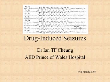 Drug-Induced Seizures