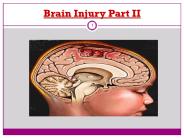 Brain Injury Part II