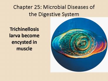 Chapter 25: Microbial Diseases of the Digestive System