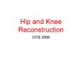 Hip and Knee Reconstruction PowerPoint PPT Presentation