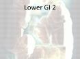 Lower GI 2 PowerPoint PPT Presentation