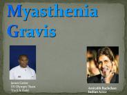 Myasthenia Gravis