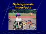 Osteogenesis imperfecta