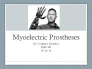 Myoelectric Prostheses