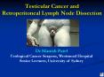 Testicular Cancer and Retroperitoneal Lymph Node Dissection PowerPoint PPT Presentation
