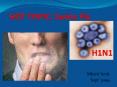 HOT TOPIC: Swine Flu PowerPoint PPT Presentation