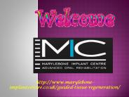 Guided Tissue Regeneration Service