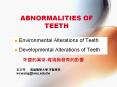 ABNORMALITIES OF TEETH PowerPoint PPT Presentation