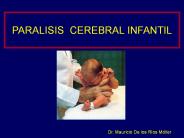 Escoliosis en la Paralisis Cerebral Infantil