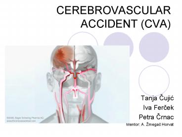 presentation player overlay