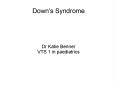 Down's Syndrome PowerPoint PPT Presentation