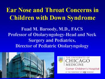 Ear Nose and Throat Concerns in Children with Down Syndrome