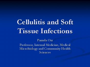 Cellulitis and Soft Tissue Infections