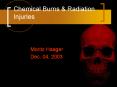 Chemical Burns PowerPoint PPT Presentation