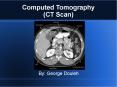 Computed Tomography (CT Scan) PowerPoint PPT Presentation