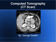 Computed Tomography (CT Scan)