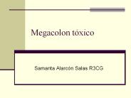 Megacolon t