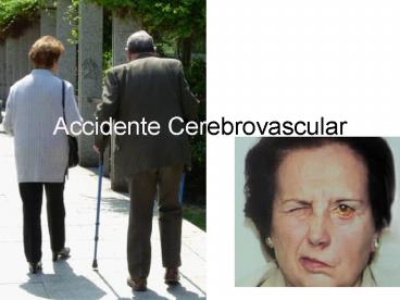 Accidente Cerebrovascular