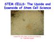 STEM CELLS: The Upside and Downside of Stem Cell Science PowerPoint PPT Presentation