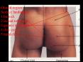 Gluteal region: PowerPoint PPT Presentation
